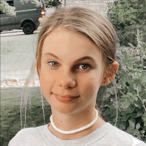 Cute Sunshine Yellow Choker